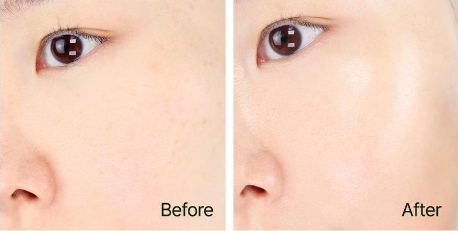 Xịt khoáng D'alba First Spray Serum 100ml - Ảnh 3