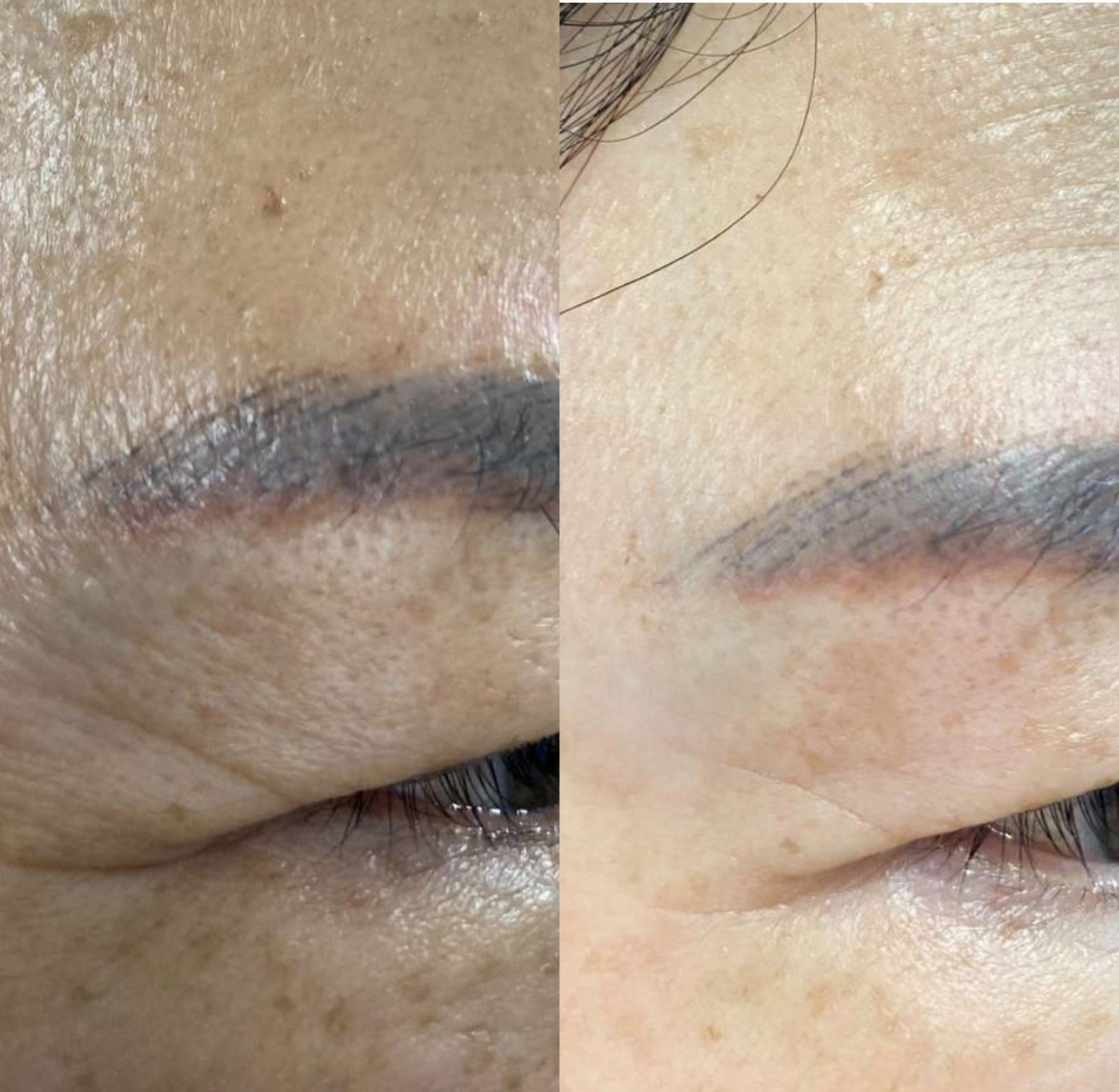 Siro siu trng da Dr.Diet Sunshine Glutathione 10X Siro siu trng da Dr.Diet Sunshine Glutathione 10X